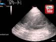 Drægtighedsscanning af Ravensbank Flo (Flo) 27-10-2015. Hun bærer hvalpe!&nbsp;&copy;Årslev Dyreklinik